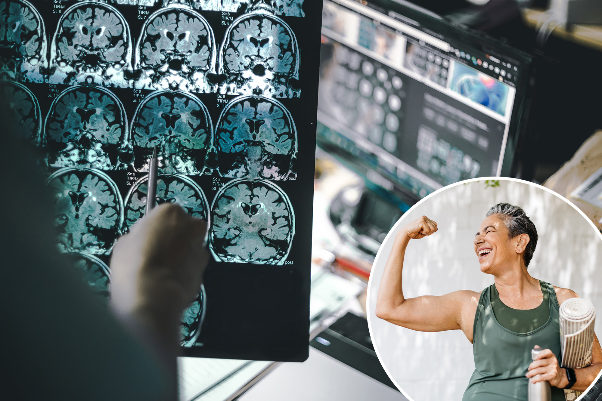 Research Reveals Key to a Healthier Brain and Lower Alzheimer’s Risk