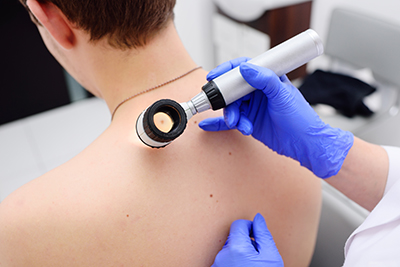Researchers Unveil Triple Therapy to Combat Melanoma Resistance